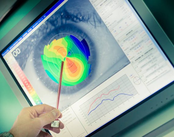 zdjęcie po topografii rogówki